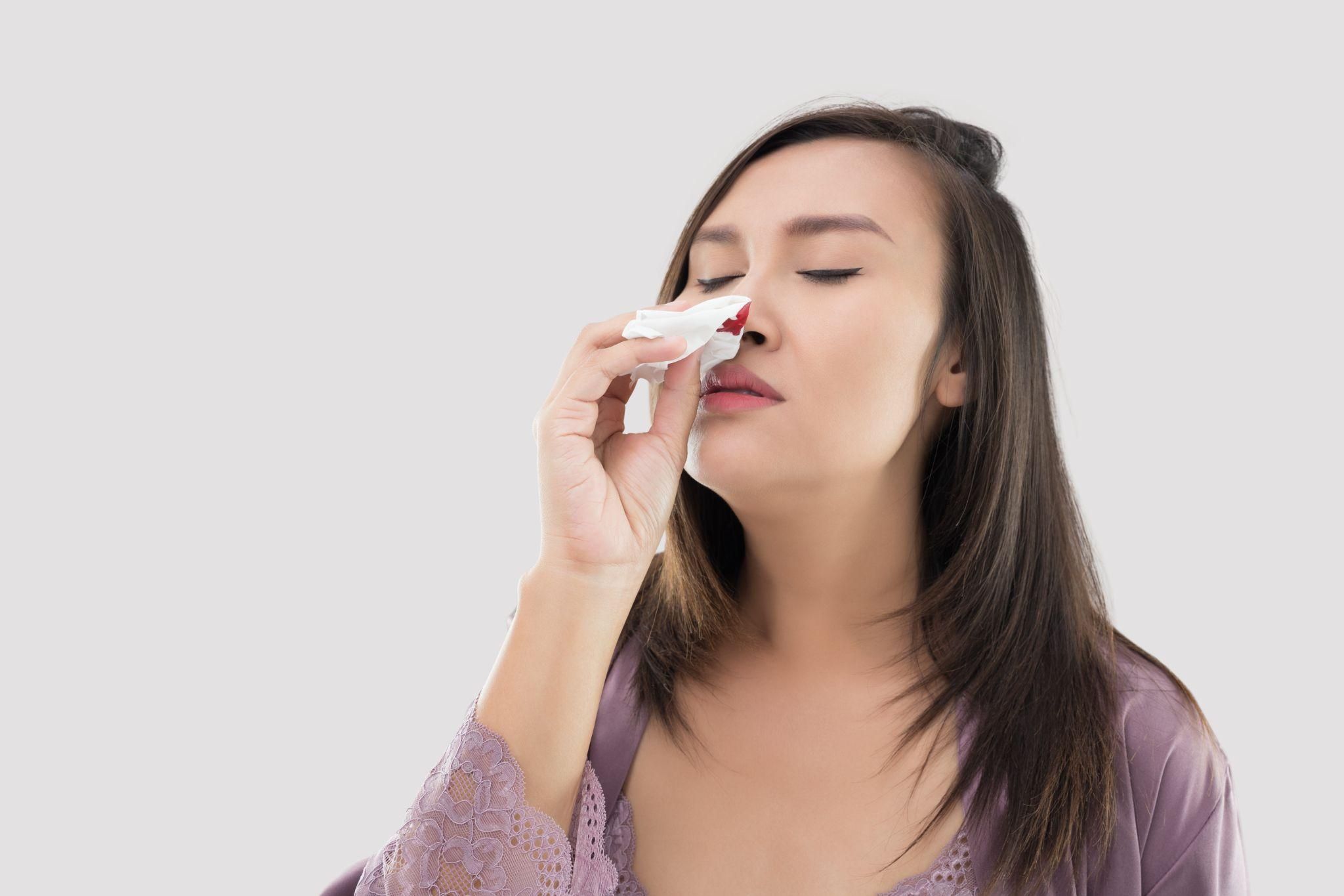 A woman experiencing a nosebleed during pregnancy.