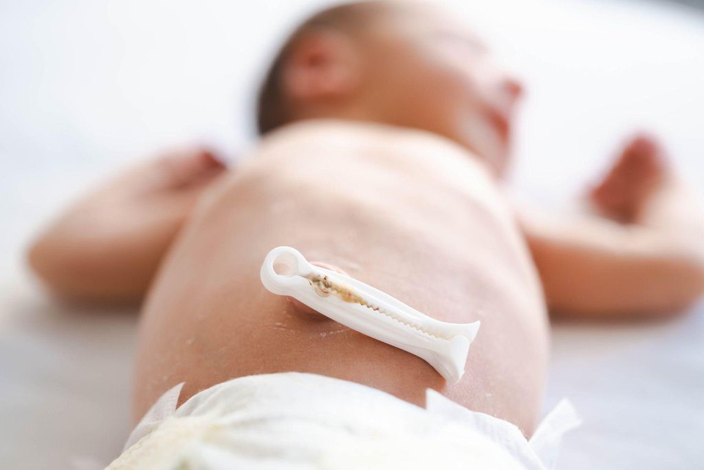 A newborn baby with the umbilical cord attached to the placenta during a lotus birth.