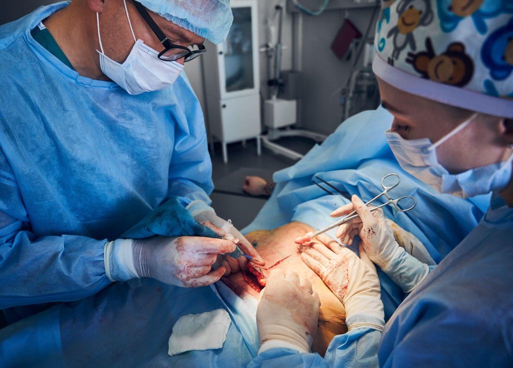 Surgeon at work on an abdomen.