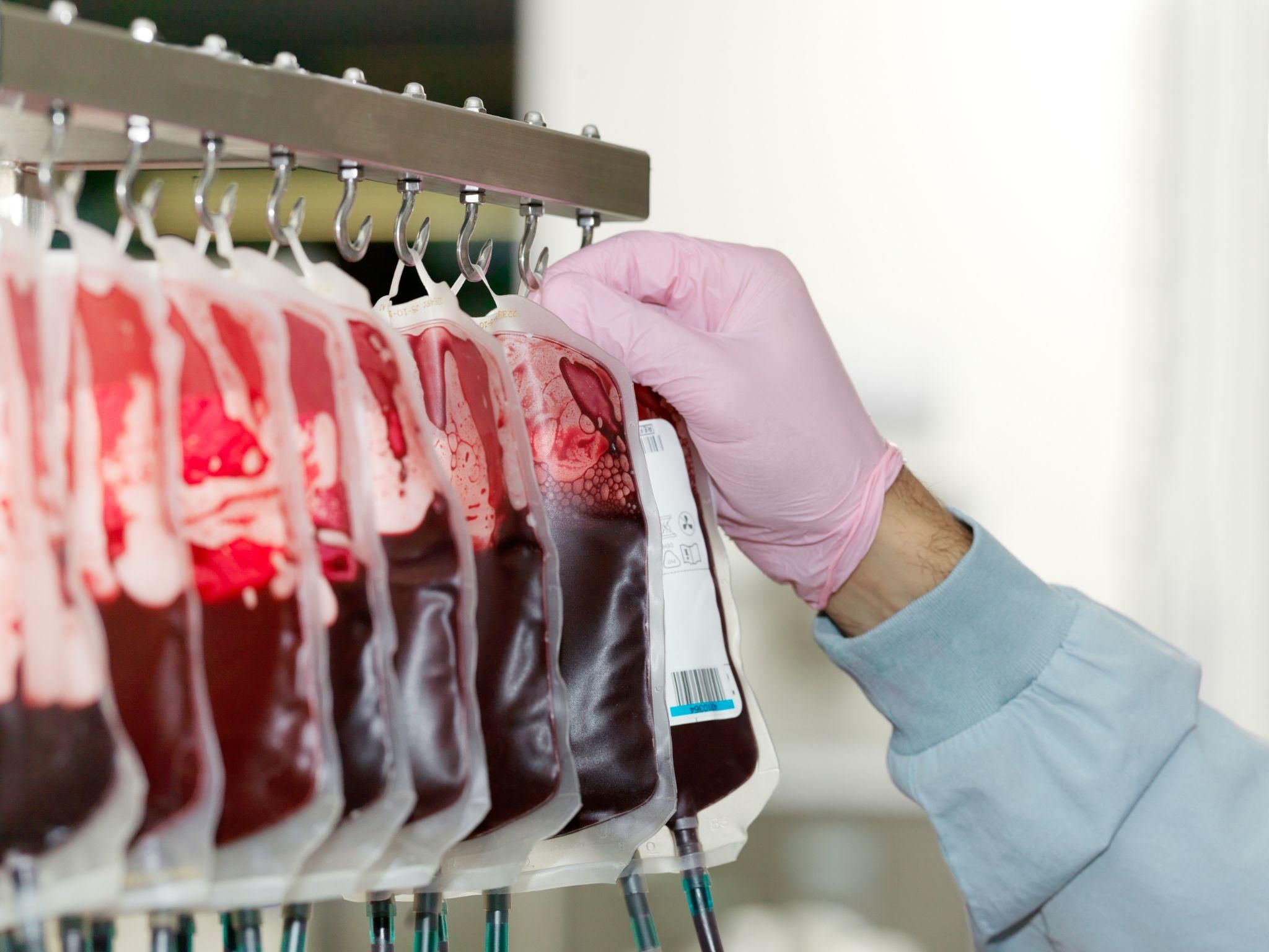 Cord blood collection kit being prepared for use after birth, a key component of antenatal planning.