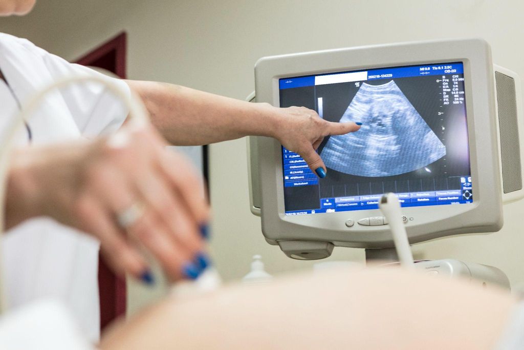 Ultrasound image showing early pregnancy scan for gender prediction.