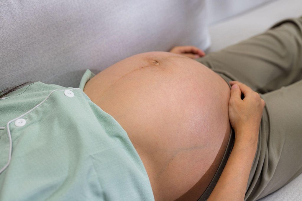 Woman in labour considering VBAC, surrounded by her supportive healthcare team.