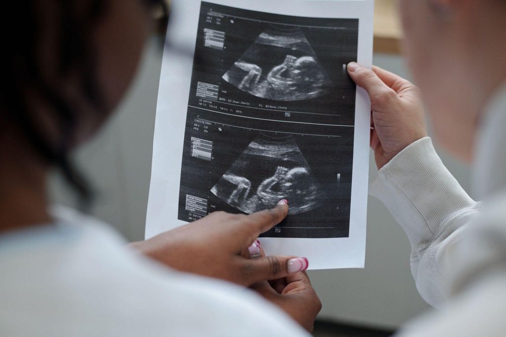 Ultrasound scan where parents chose not to know the baby’s gender.