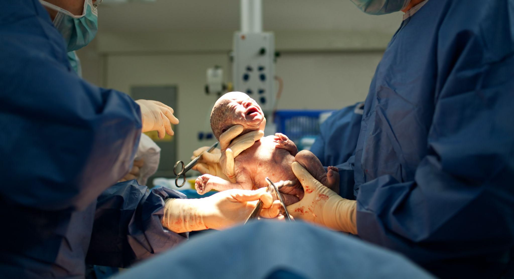 A mother recovering from her second C-section, balancing care for her newborn and older child.