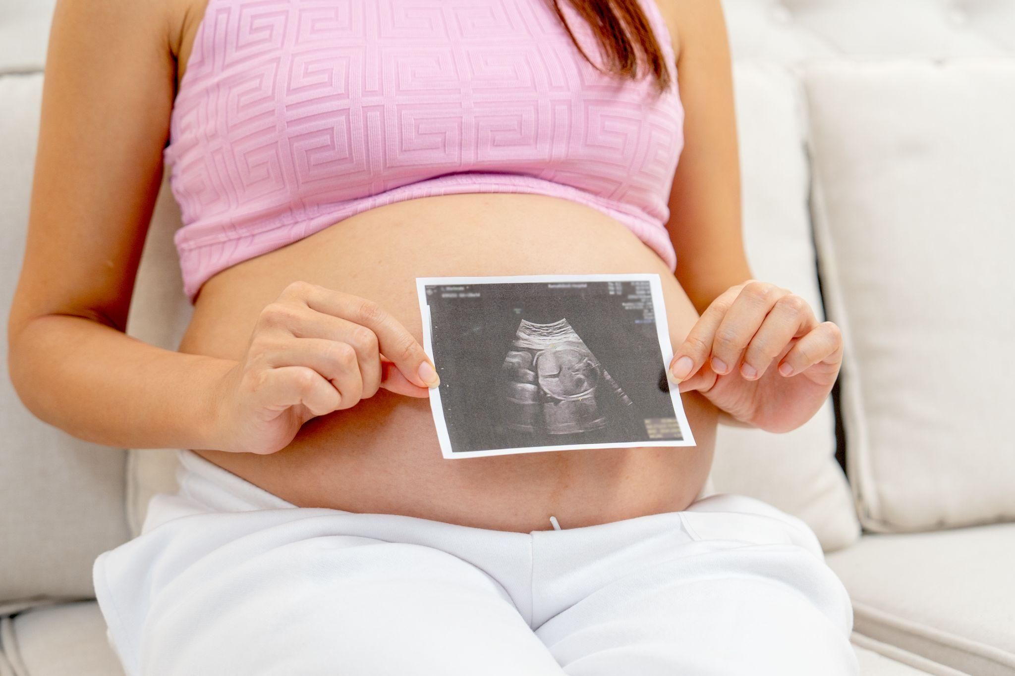 Pregnant woman having an antenatal scan with healthcare provider.