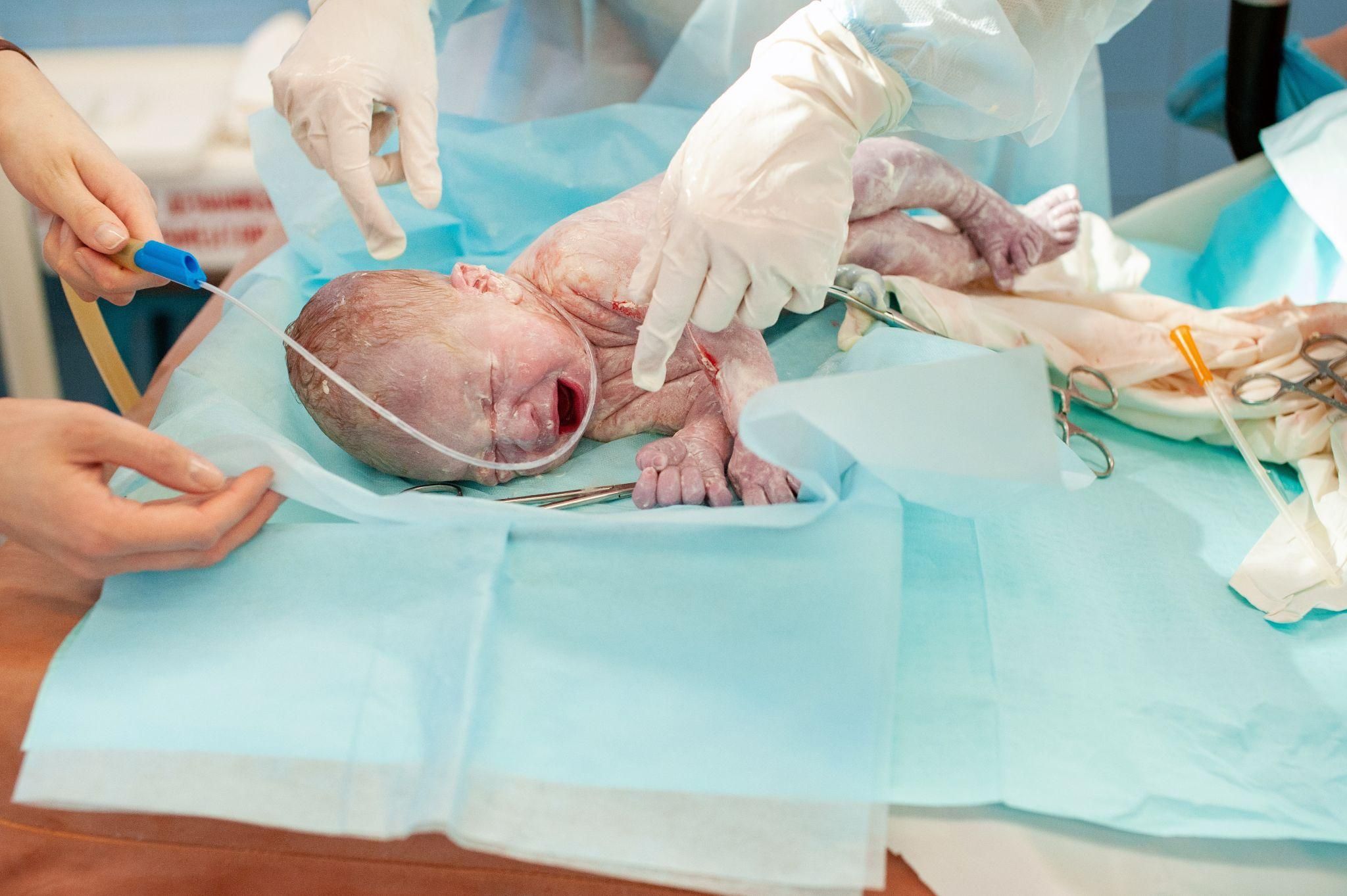 Newborn baby with the umbilical cord attached, indicating delayed cord clamping.